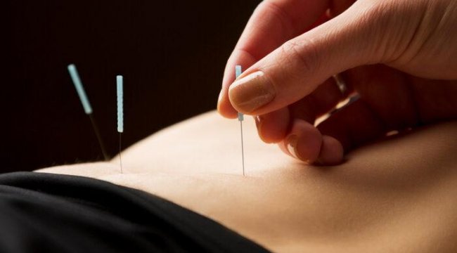 Akupunktur yöntemiyle gastrit ve reflü tedavisi mümkün!