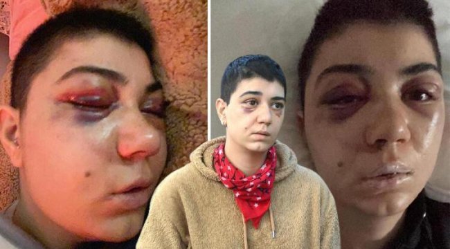 Beyoğlu'nda kadına felç eden şiddet! Kabusu yaşadı