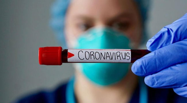 Son dakika haberi: 15 Nisan corona virüsü tablosu ve vaka sayısı Sağlık Bakanlığı tarafından açıklandı!