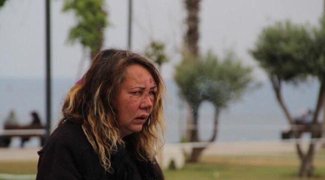 Antalya'da Rus kadına saldırı! Sahilde darp edildi