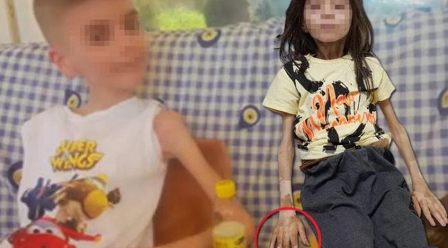 SON DAKİKA| Çöp evde bulunan çocuğun sağlık durumu nasıl? Hastaneden açıklama geldi, kilosu şaşkına çevirdi